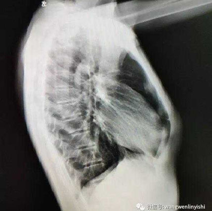 术前的X线检查