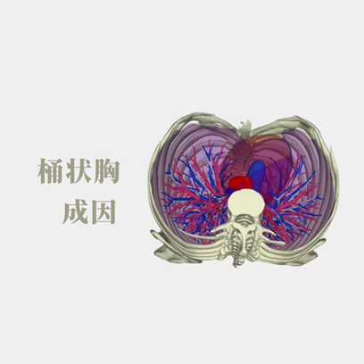 桶状胸的成因是什么？