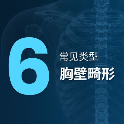 胸壁畸形的六种常见类型