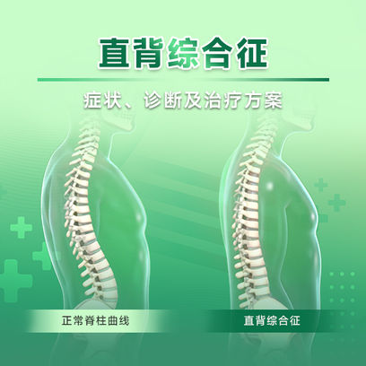 什么是直背综合征？常见症状与治疗选择