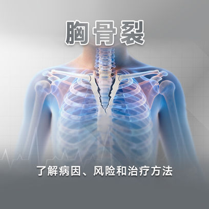胸骨裂：了解病因、风险和治疗方法